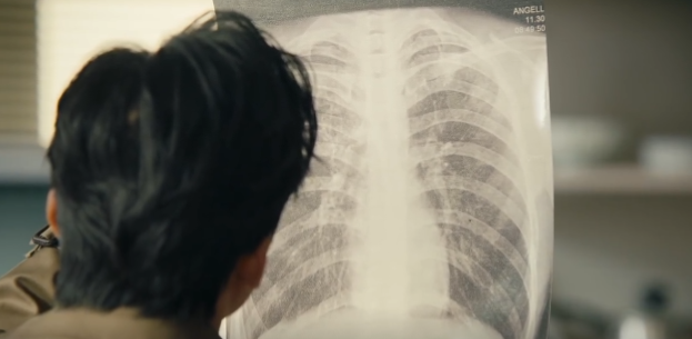 尘肺/矽肺生活指南：饮食禁忌与日常防护